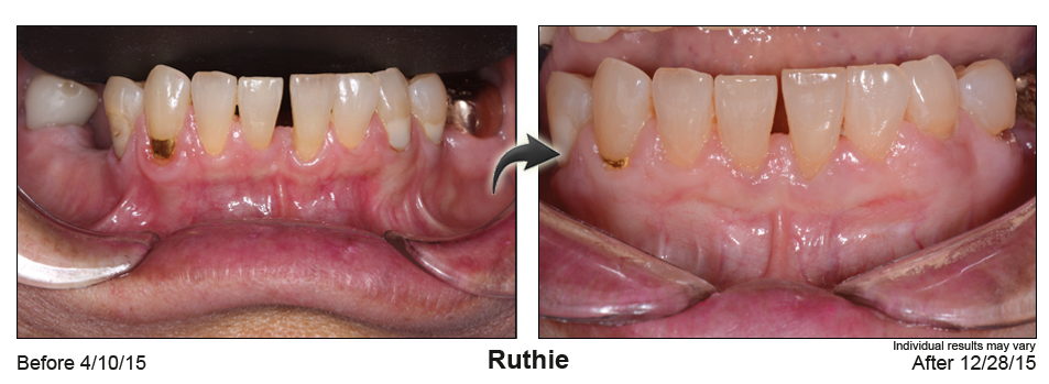 pst dentist Brighton Colorado